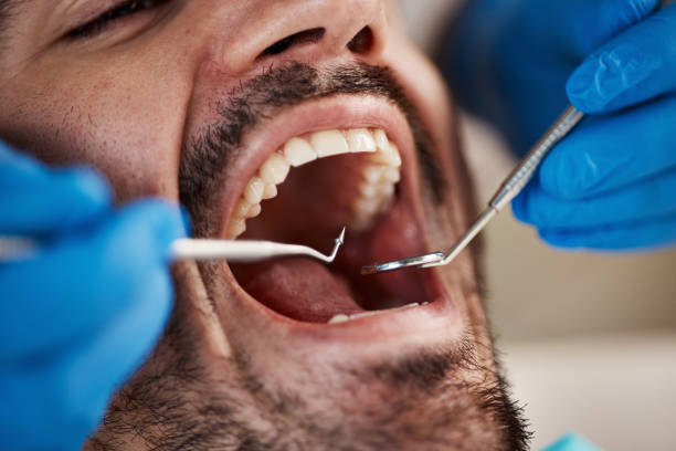 Best Emergency Gum Pain Relief  in Wolcott, IN